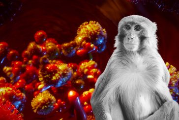 Detectan dos casos más de probable viruela del mono en Jalisco