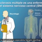 LA ESCLEROSIS MÚLTIPLE ES MÁS COMÚN EN JÓVENES ADULTOS Y MUJERES