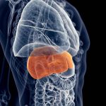 LA HEPATITIS SE PUEDE CONVERTIR EN CÁNCER HEPÁTICO, SI NO SE CUIDA