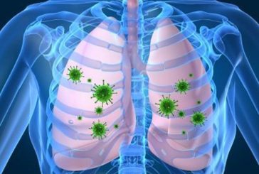 EL MAL MANEJO DE LA NEUMONÍA PUEDE DESENCADENAR RESISTENCIA BACTERIANA
