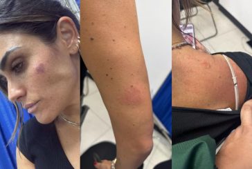 Agreden a alcaldesa Alessandra Rojo de la Vega durante operativo de reordenamiento en San Cosme